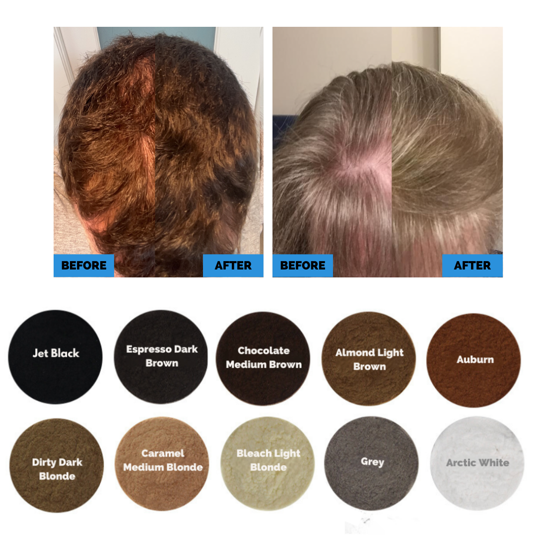 Hair Fibres Bundle Starter Pack