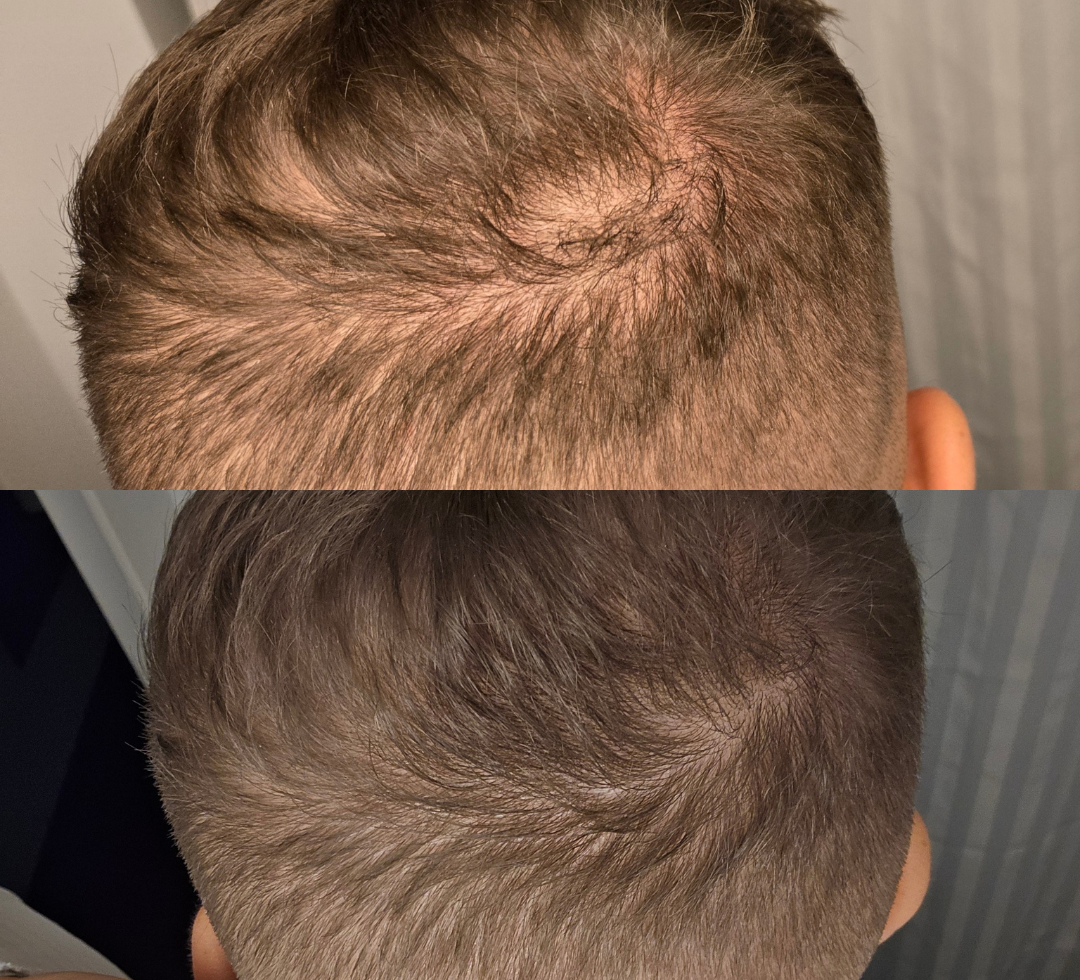 Hair Building Fibres